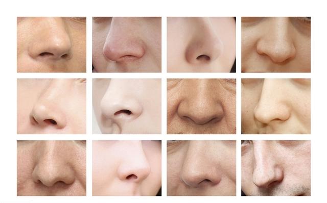 鼻部皮肤薄或厚，在鼻整形时应注意什么？