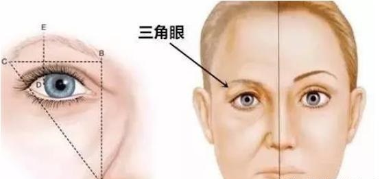 提眉手术什么年龄做合适？听说它与"割双眼皮"有相似之处...