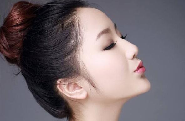 韩式隆鼻假体手术的特点是什么?假体能用几年?