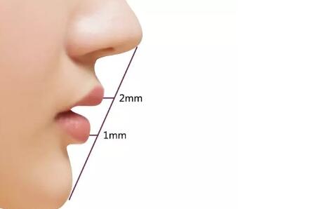 北京韩式隆鼻假体手术时间长吗？手术是怎样的？