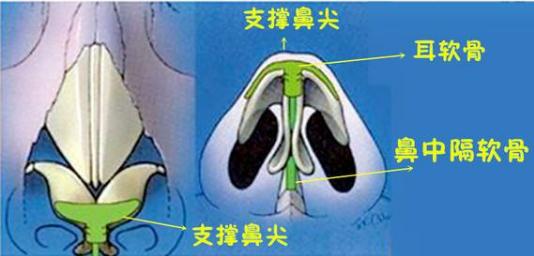 鼻中隔隆鼻手术想要效果好，医生技术很重要！