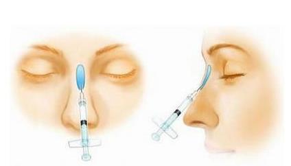 注射隆鼻手术的缺点：