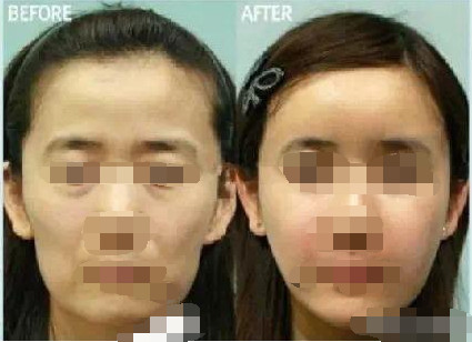 面部衰老怎么解决  _怎样可以防止面部皮肤衰老